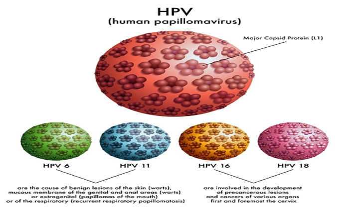 Condyloma a hüvely nagyságában Hpv az az oltás